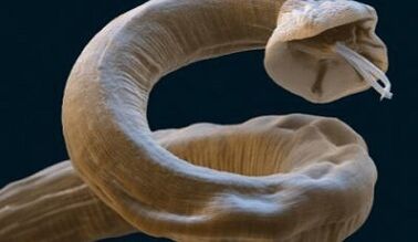Ascaris parasite in the human body