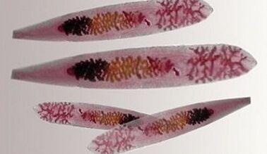 Opisthorchis parasites in the human body