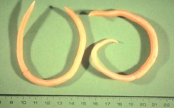 pinworm from the human body