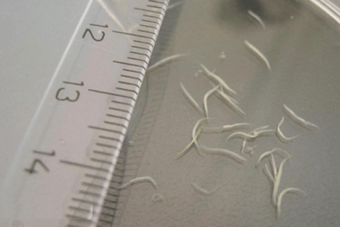 how to remove worms from a child
