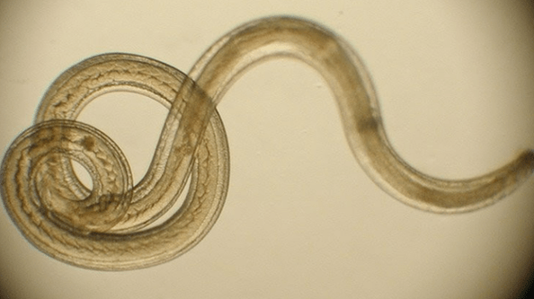 worm parasite from the human body