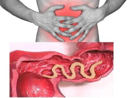 Signs of chronic helminthiasis are a dyspeptic bowel disorder