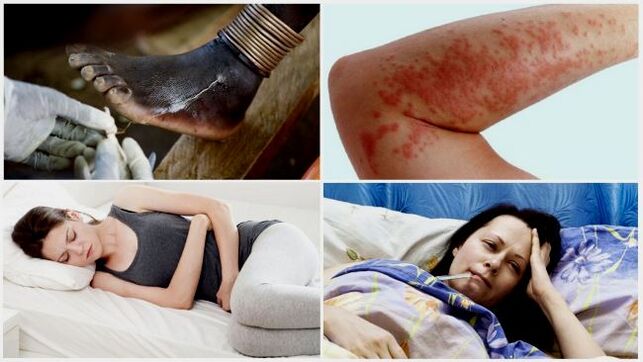 Common symptoms of subcutaneous parasite infection