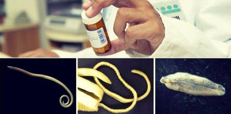 Types of worms and a medicinal method of getting rid of them